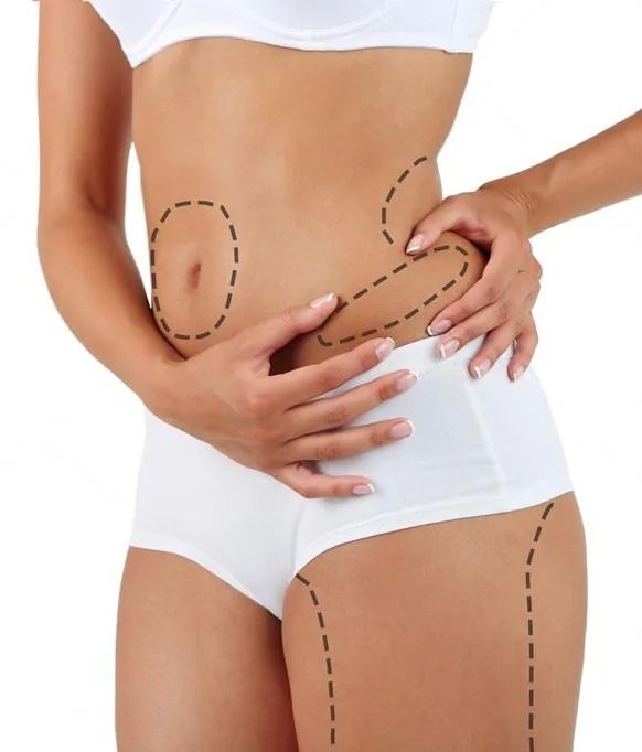 liposuctie-cluj liposuctie-cluj